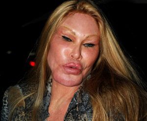 Jocelyn Wildenstein