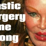Celebrity Plastic Surgery Gone Wrong