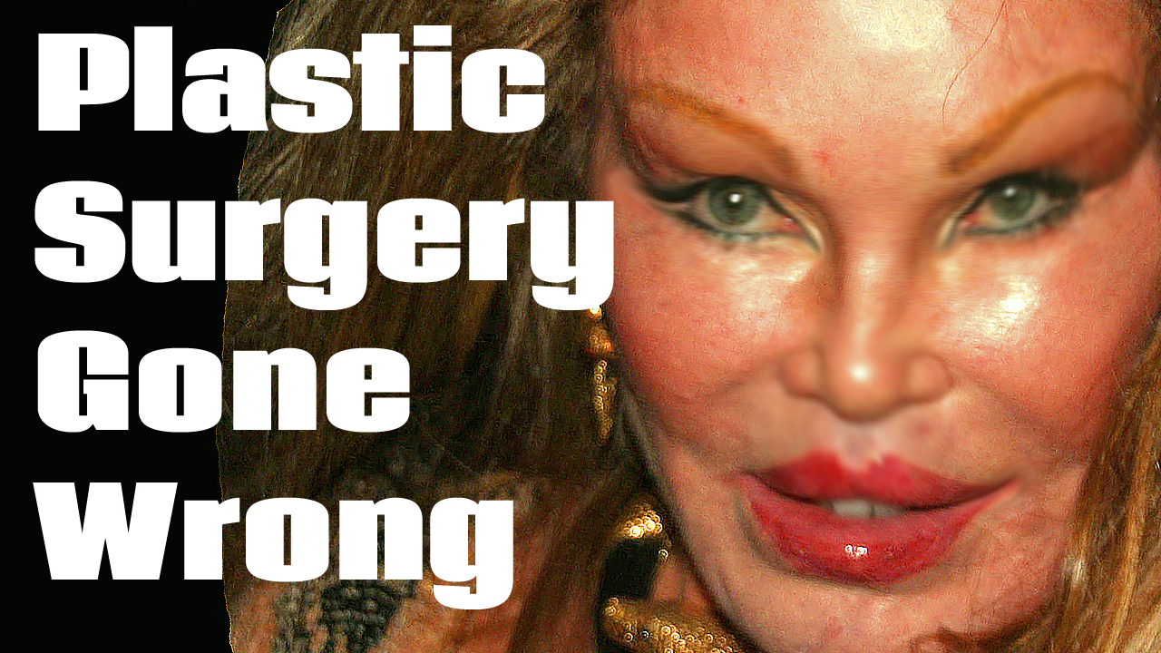 Celebrity Plastic Surgery Gone Wrong | DinoCreek.com | Amazing Videos